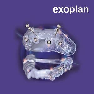 Exoplan