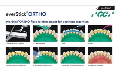 everStick ORTHO