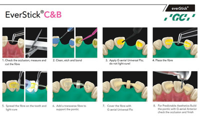 everStick C&amp;B