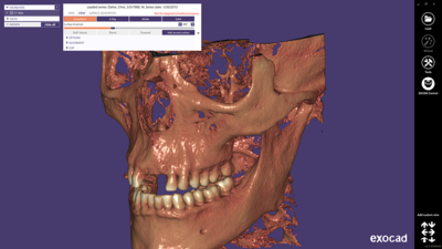 DICOM Viewer modul