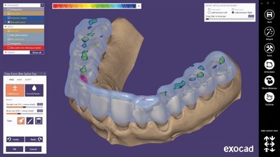 Bite Splint modul