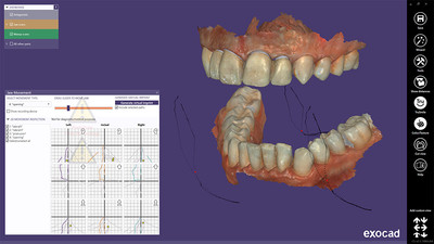 Jaw Motion Import modul