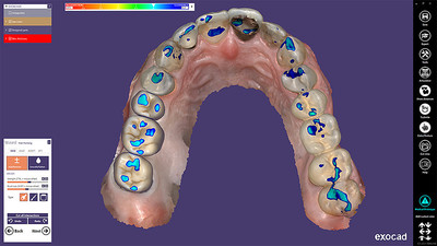 Auto Articulator modul